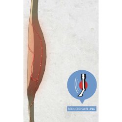 Kentucky Magnetic Bandage Underlag